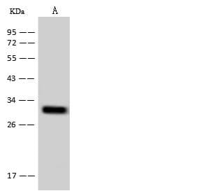 Polyclonal Rabbit anti-Human TM2D2 Antibody (WB)