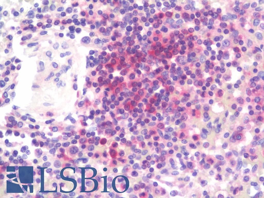 IHC-plus™ AMPD3 Antibody (aa541-776)