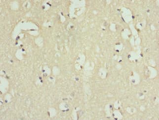Polyclonal Rabbit anti-Human IL9R / CD129 Antibody (IHC)