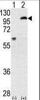 PRKCE / PKC-Epsilon Antibody (aa206-236)