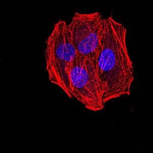 AGR2 Antibody (clone 7H2H7)