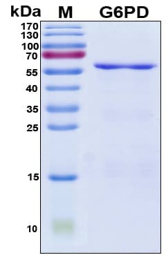Human G6PD Protein (Recombinant His, N-Terminal)