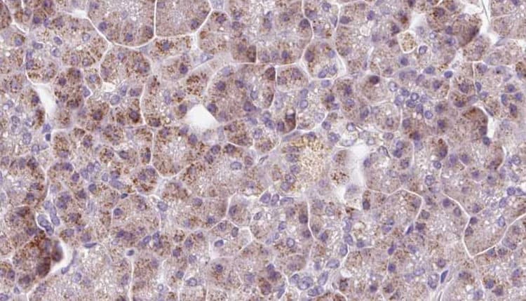 DDC / DOPA Decarboxylase Antibody