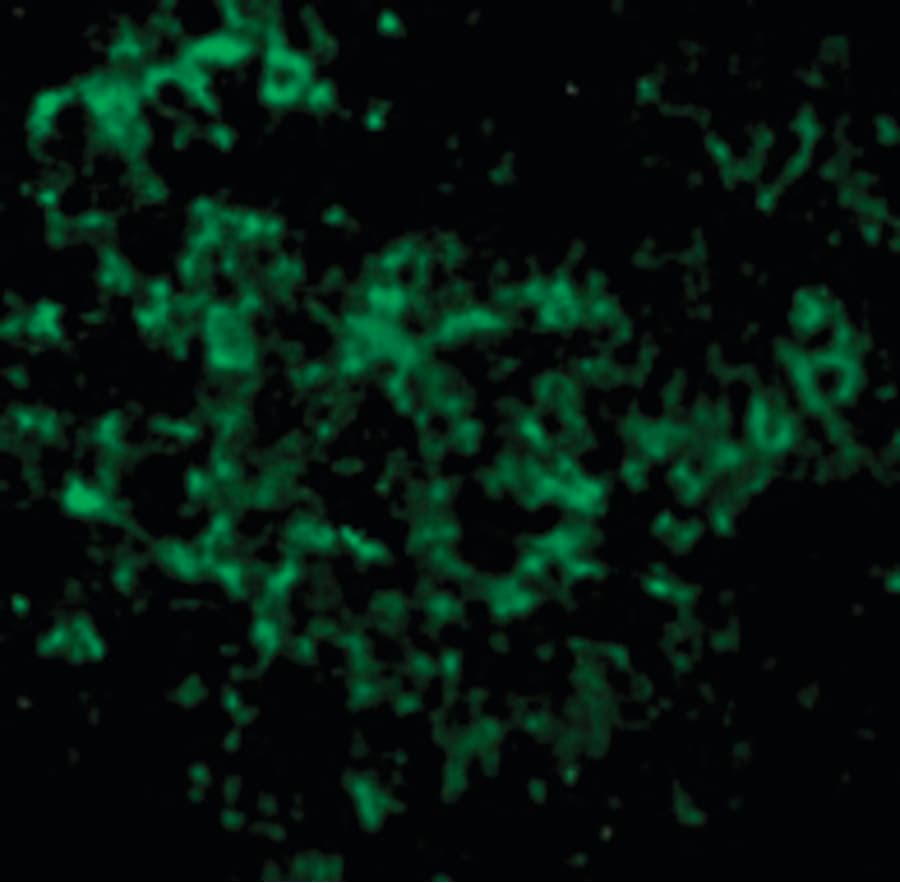 IHC-plus™ Polyclonal Rabbit anti-Human UBE2N / UBC13 Antibody (IHC, IF, WB)