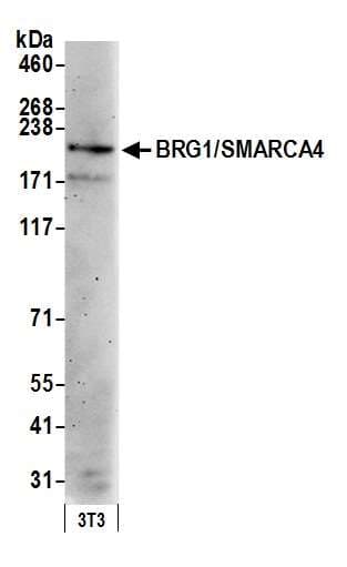 PathPlus™ SMARCA4 / BRG1 Antibody (aa75-125)