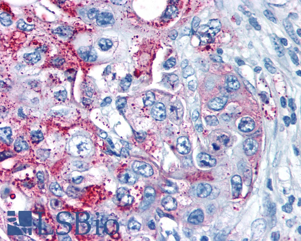 PathPlus™ GPRC5A / RAI3 Antibody (Transmembrane Domain)
