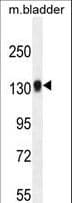 TDRD7 Antibody (aa807-835)