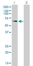 ALPL / Alkaline Phosphatase Antibody (clone 4H1)