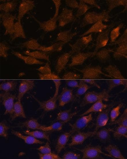 KRAS Antibody