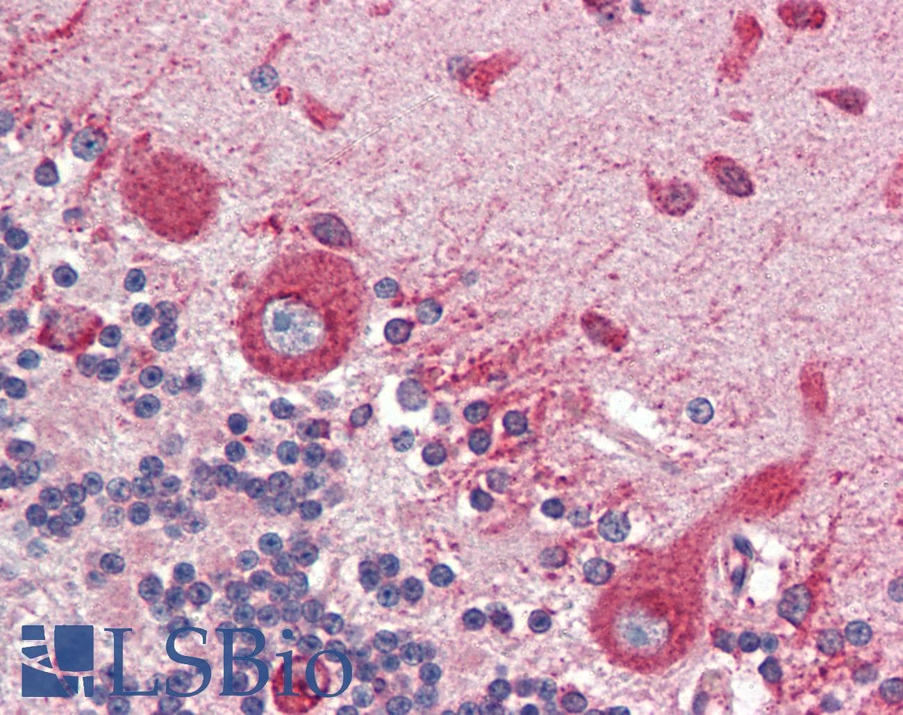 IHC-plus™ Monoclonal Mouse anti-Human CALR3 Antibody (clone 1G6A7, IHC, IF, WB)