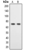 DYRK1B Antibody (Internal)