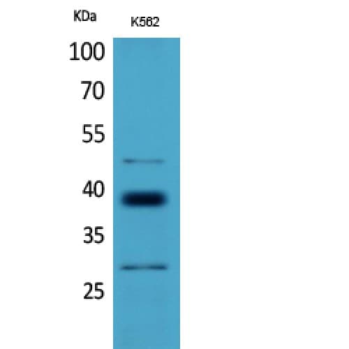 CD1D Antibody (161-210 aa, Internal)