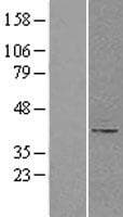 B4GALT1 Protein (Over-Expression Lysate Myc-DDK (Flag))