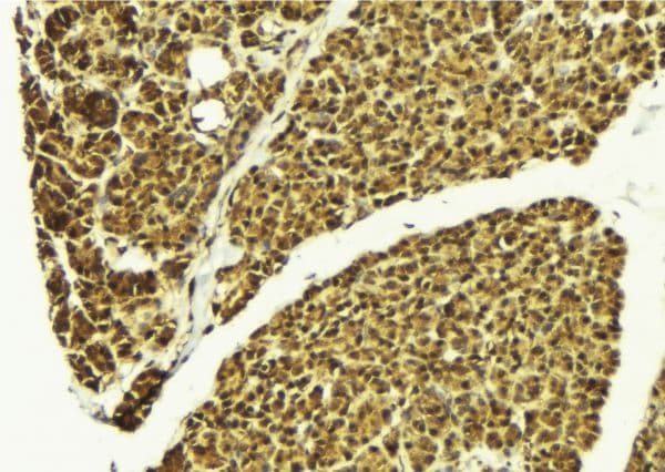 Polyclonal Rabbit anti-Human Survival Motor Neuron Domain Containing 1 (SMNDC1) Antibody (IHC, IF, WB)