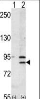 BRD2 / RING3 Antibody (aa170-200)