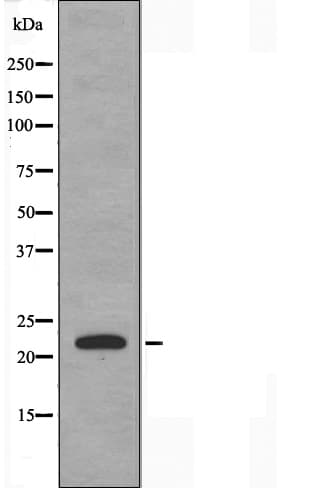 CSRP1 Antibody