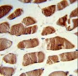 CSRP2BP Antibody (aa246-275)