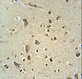 CARNS1 Antibody (aa239-268)
