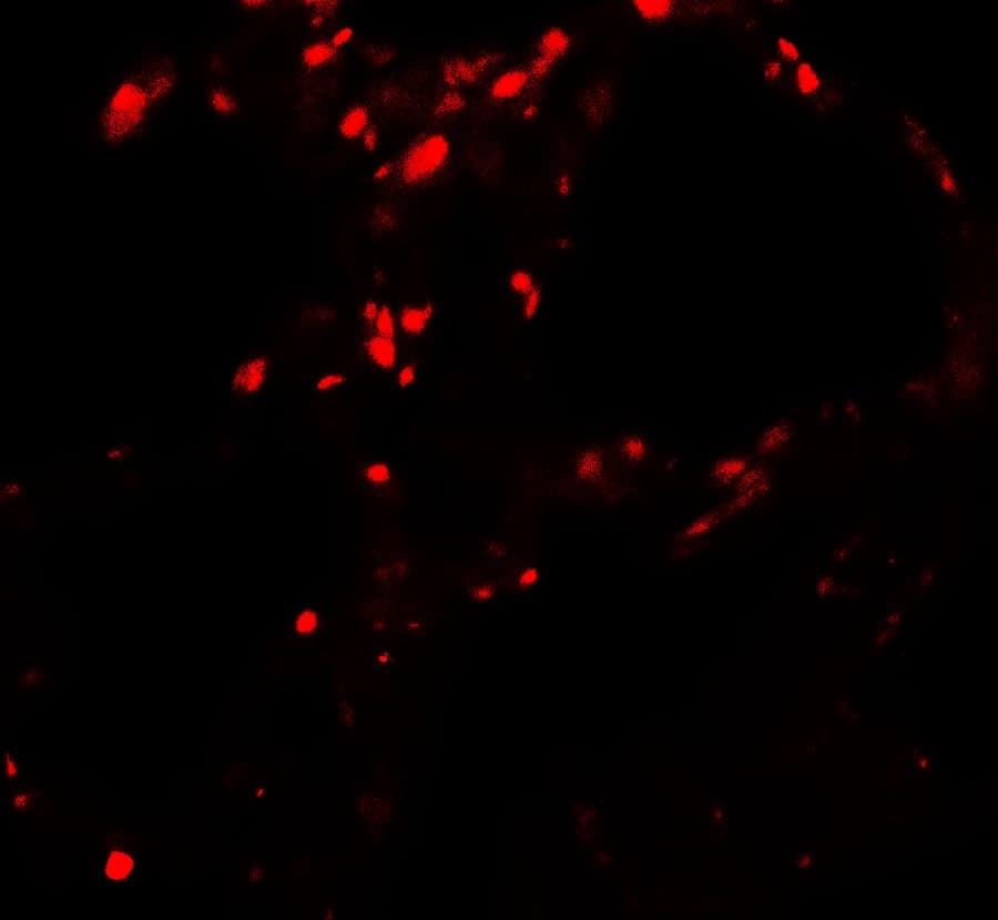 IHC-plus™ Polyclonal Rabbit anti-Human BAMBI Antibody (IHC, IF, WB)