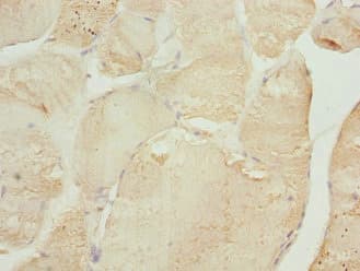 TNNI2 Antibody