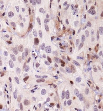 JHDM1A / KDM2A Antibody (Biotin)