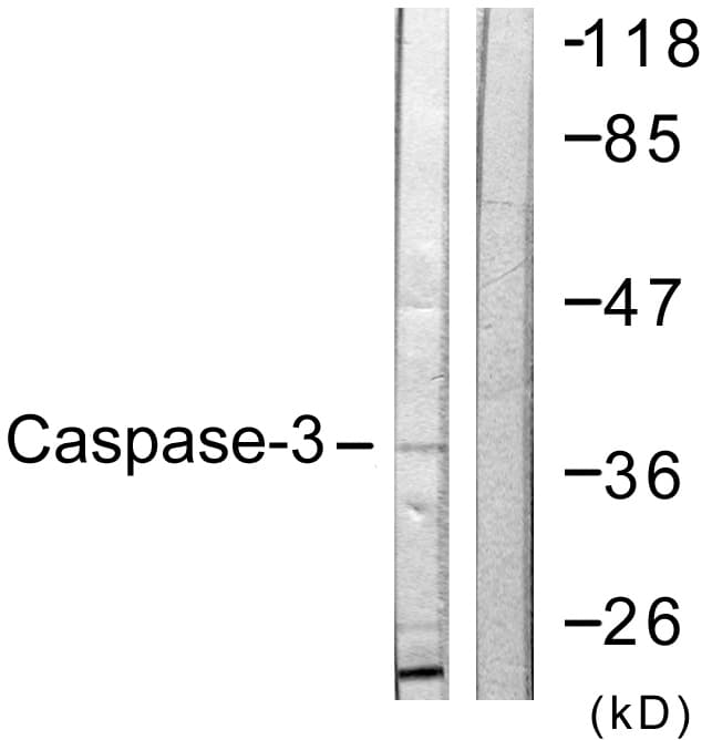 CASP3 / Caspase 3 Antibody (aa116-165)