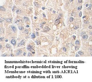 Polyclonal Rabbit anti-Human AKR1A1 Antibody (IHC, WB)