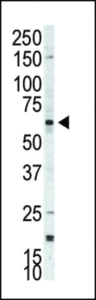 RPS6KB2 / S6K2 Antibody (aa452-482)