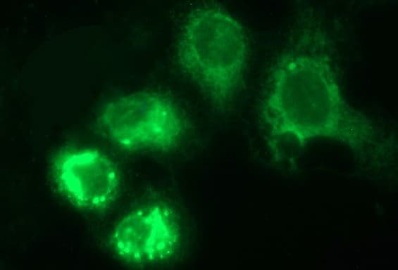 HERPUD1 / HERP Antibody (clone OTI1A2)