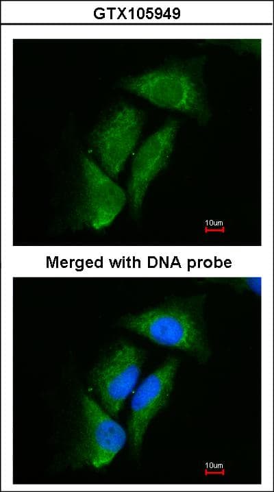Dipeptidyl Peptidase 3 / DPP3 Antibody (aa138-465)