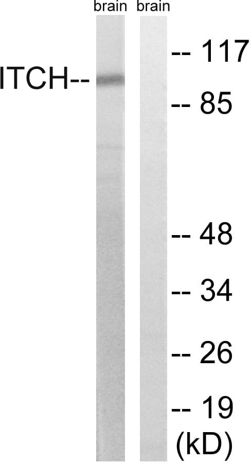 Polyclonal Rabbit anti-Human ITCH / AIP4 Antibody (aa386-435, WB)