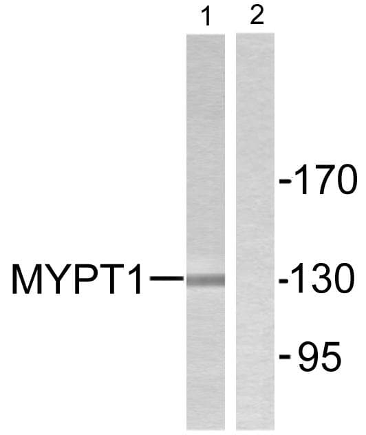 Polyclonal Rabbit anti-Human PPP1R12A / MYPT1 Antibody (p853, IHC, WB)