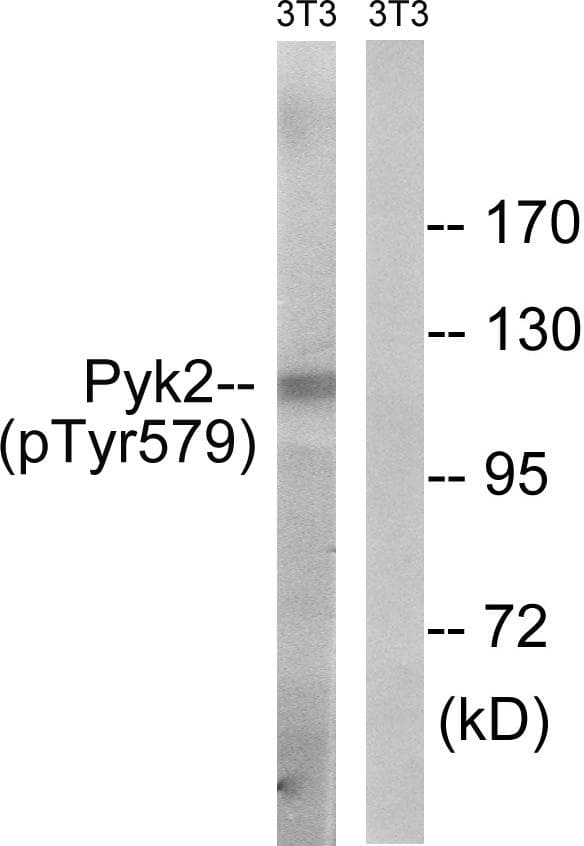 PTK2B / PYK2 Antibody (phospho-Tyr579)
