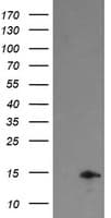 TPD52L3 Antibody (clone OTI4G6)