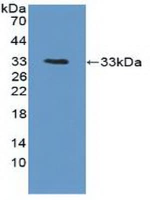 Polyclonal Rabbit anti-Human PTK6 / BRK Antibody (aa191-445, WB)
