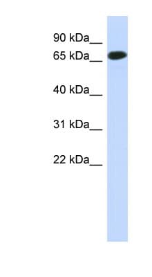 Polyclonal Rabbit anti-Human CCDC185 Antibody (N-Terminus, WB)
