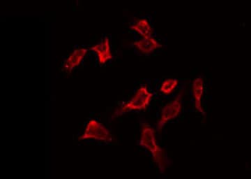 PFKFB1 Antibody