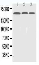 EGFR Antibody (aa25-346)