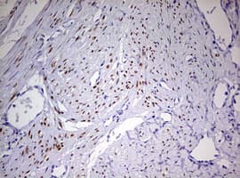 PR / Progesterone Receptor Antibody (aa1-298, clone OTI6E3)