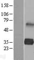 LDLRAD2 Protein (Over-Expression Lysate Myc-DDK (Flag))