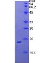 Human PSPLA1 / Phospholipase A1 Protein (Recombinant His)