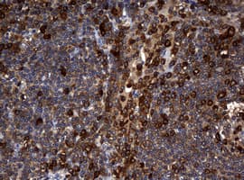 NME1 / NM23 Antibody (clone OTI2D8)