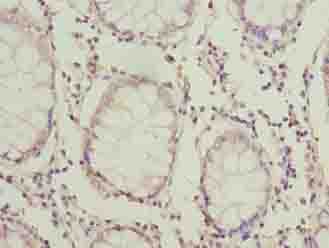 Polyclonal Rabbit anti-Human HOOK1 Antibody (IHC, WB)