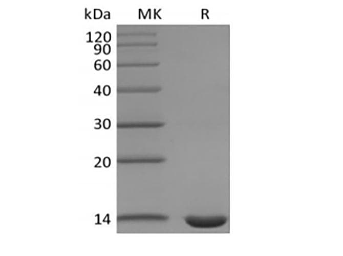 Mouse Leptin Protein (Recombinant)