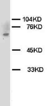 CHEK2 / CHK2 Antibody (C-Terminus)