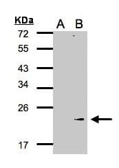 Polyclonal Rabbit anti-Human GPX7 Antibody (aa1-187, IHC, WB)