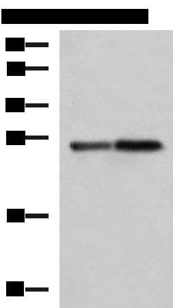 CTRB1 / Chymotrypsinogen B1 Antibody