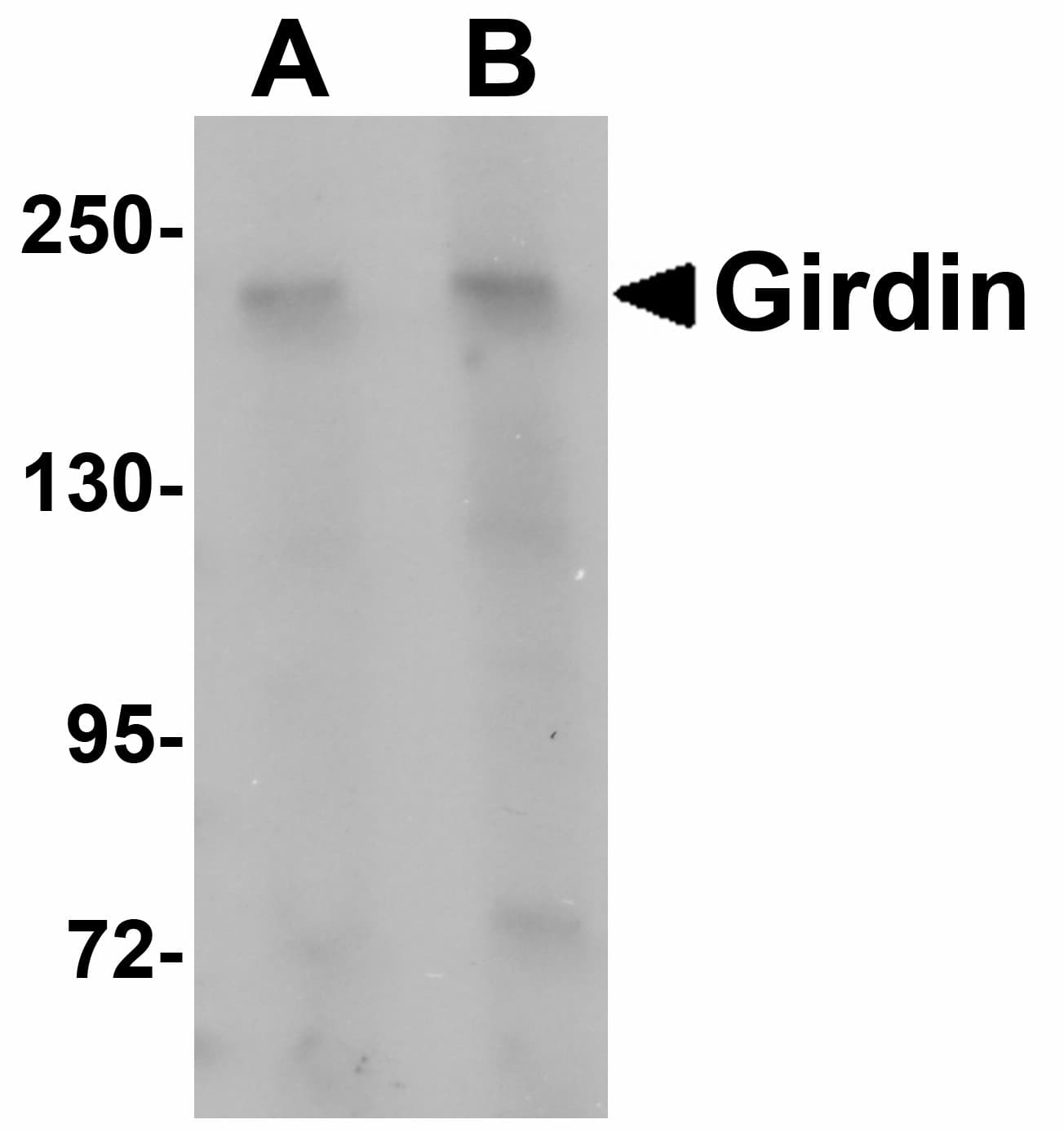IHC-plus™ Polyclonal Rabbit anti-Human CCDC88A / GIV / Girdin Antibody (IHC, IF, WB)