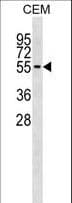 Polyclonal Rabbit anti-Human ERMAP / SC Antibody (aa69-95, WB)