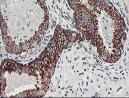 CAST / Calpastatin Antibody (clone OTI1E7)